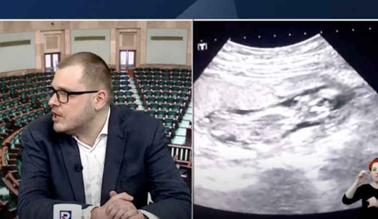 Aborcja jako temat zastępczy koalicji 13 grudnia | Republika Wieczór [wideo]