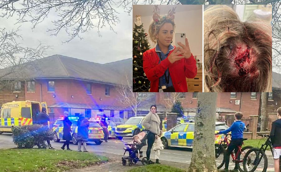 poszkodowana w szpitalu Newton-le-Willows