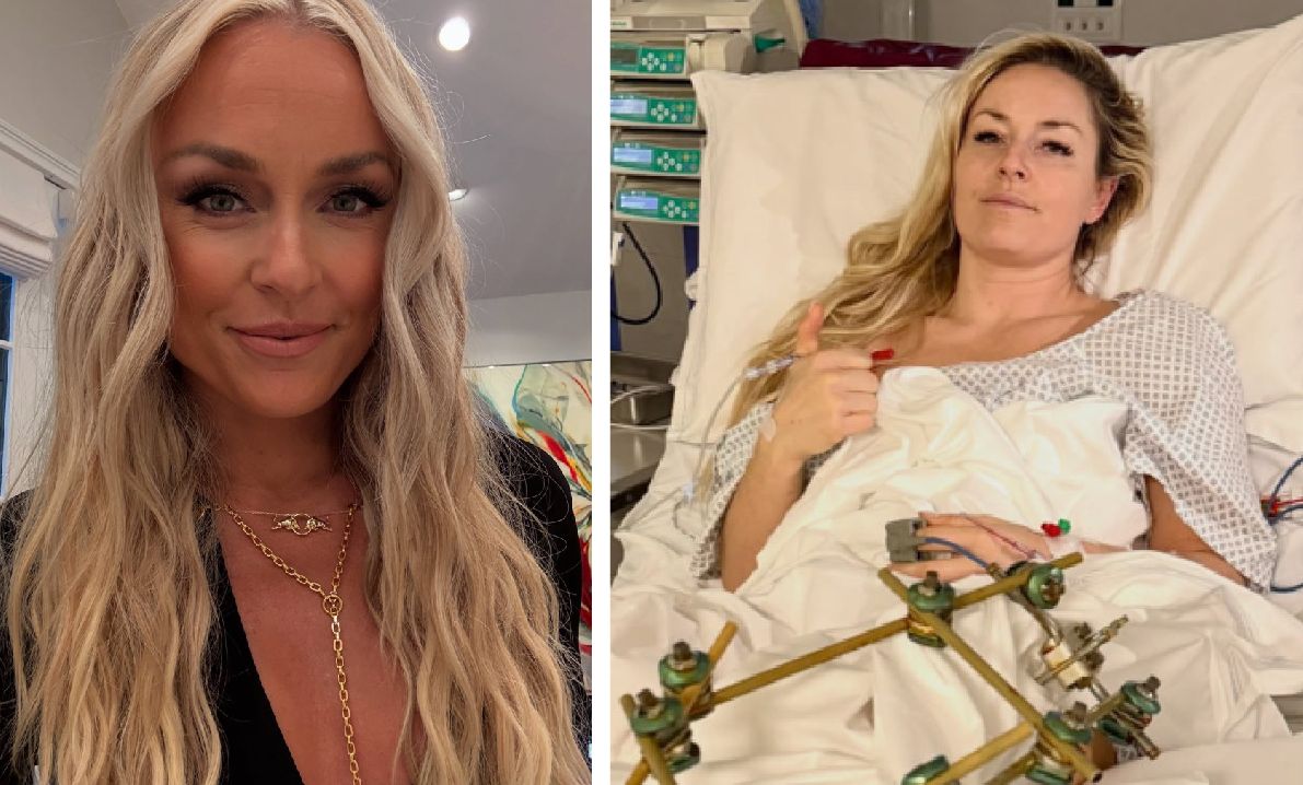 Lindsey Vonn po 8 operacjach
