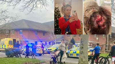 poszkodowana w szpitalu Newton-le-Willows