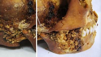 operacja szczęki 2500 lat temu