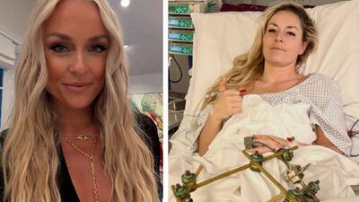 Lindsey Vonn po 8 operacjach