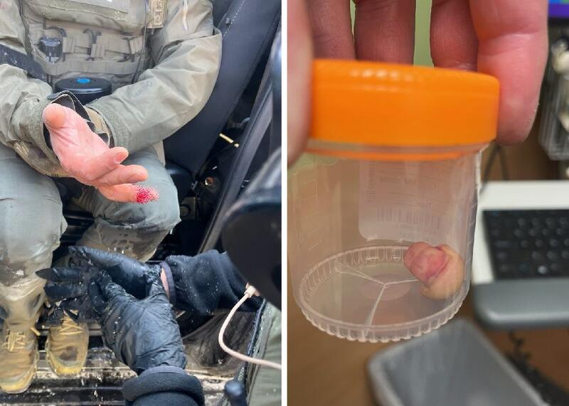 odgryzł palec funkcjonariuszowi federalnemu